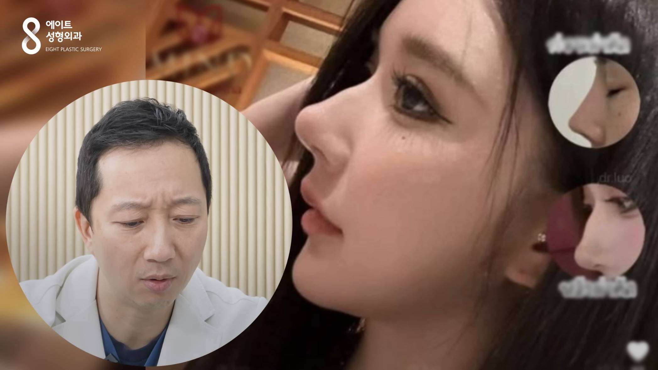 요즘 중국에서 유행이라는 코수술 모양.jpg | 인스티즈